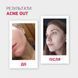 *Уцінка*_ЗВОЛОЖУВАЛЬНИЙ КРЕМ "ГІДРО АКТИВ" ACNE OUT 60 мл